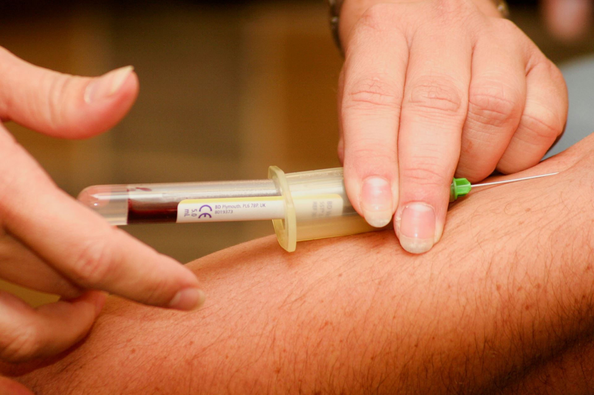 Blood being taken from arm for testing 